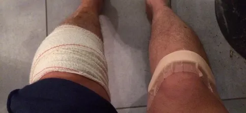 Amiens : un chirurgien se trompe de genou lors d'une opération