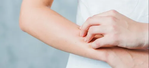 Crise de démangeaisons dans une école des Ardennes