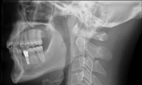 Bonne action : apportez vos vieilles radiographies chez votre...