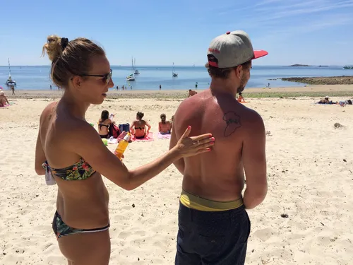 C'est la semaine du dépistage du cancer de la peau