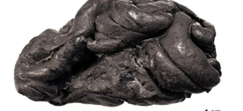 Un chewing-gum vieux de 5700 ans !