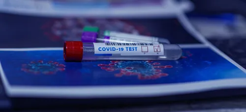 Les tests antigéniques bientôt possibles en pharmacie