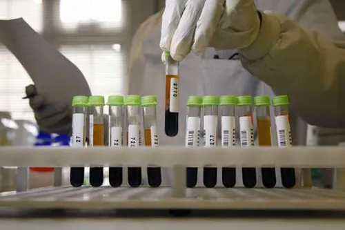 Vers un test sanguin universel pour détecter précocement le cancer ?