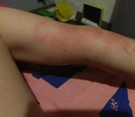 Toulon : des punaises de lit au cinéma, des clients en font les frais