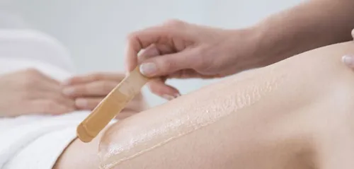 Marseille : l’esthéticienne ponçait les vergetures avec du papier...