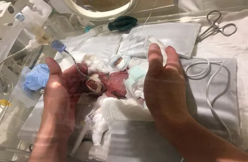 Japon : né à 268g, un bébé a pu sortir de l’hôpital en bonne santé