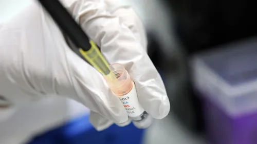 Des scientifiques gallois ont découvert une cellule qui s'attaque à...