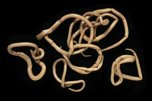 Un homme infecté d'un ver d'1,70 mètre après avoir mangé trop de...