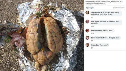 Il trouve un cerveau enveloppé dans du papier aluminium sur une plage