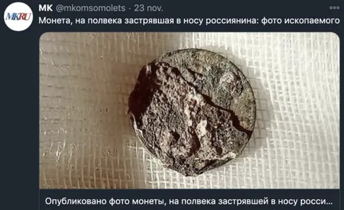 Il se plaint d’une douleur au nez, les médecins lui retirent un...