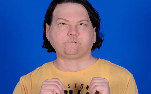 New York : un homme greffé avec succès du visage et des deux mains