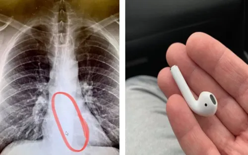 Il avale l'un de ses AidPods en dormant...