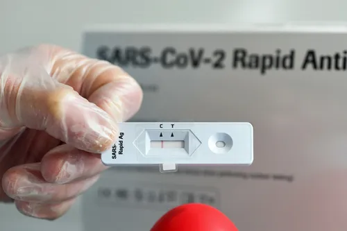 Covid-19 : les autotests disponibles à la vente "dès cette semaine"